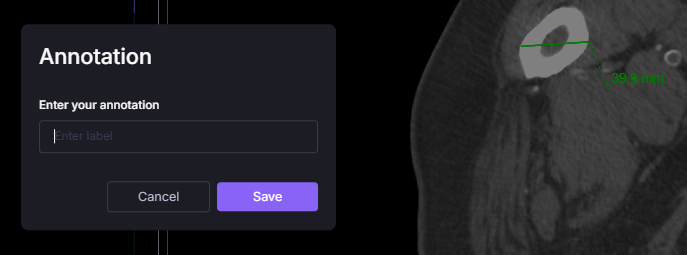 Annotation Prompt
