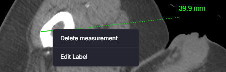 Delete Context Menu