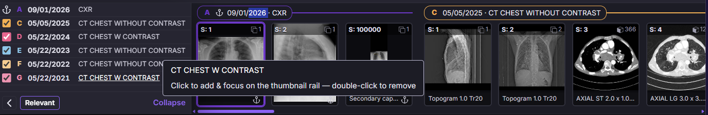 Study Selector and Thumbnail Rail